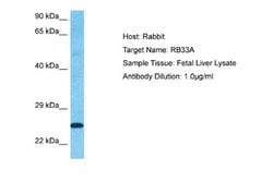 RAB33A Rabbit anti-Human, Polyclonal, Novus Biologicals 0.1ml; Unconjugated:Antibodies,